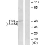 Western Blot - Anti-p53 (phospho Ser33) Antibody (A7182) - Antibodies.com