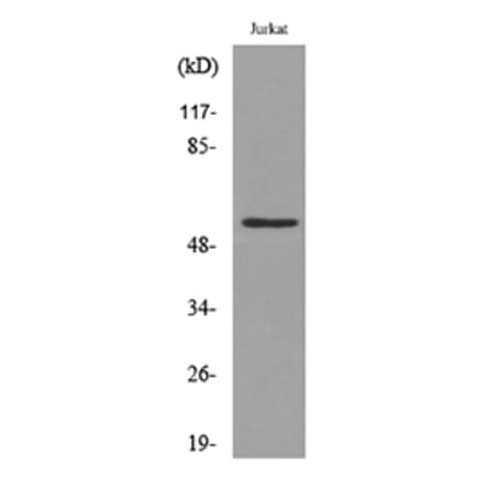 Western Blot - Anti-p53 (acetyl Lys372) Antibody (D12172) - Antibodies.com