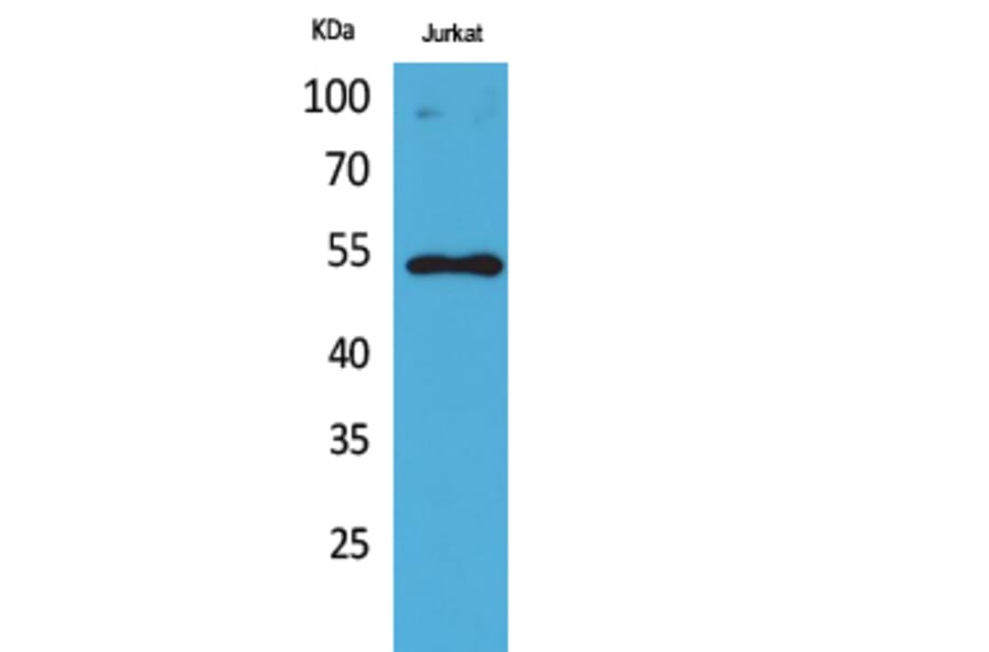 Western Blot - Anti-p53 (acetyl Lys372) Antibody (D12172) - Antibodies.com
