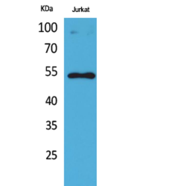 Western Blot - Anti-p53 (acetyl Lys372) Antibody (D12172) - Antibodies.com