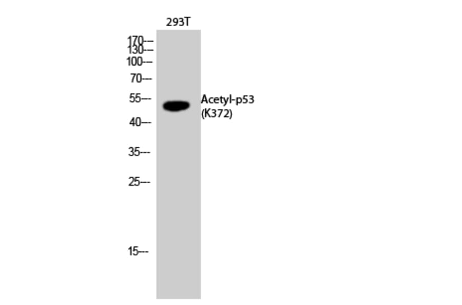 Western Blot - Anti-p53 (acetyl Lys372) Antibody (D12172) - Antibodies.com
