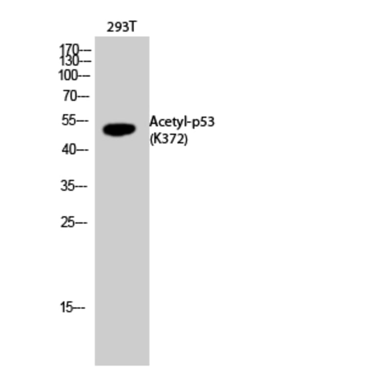 Western Blot - Anti-p53 (acetyl Lys372) Antibody (D12172) - Antibodies.com