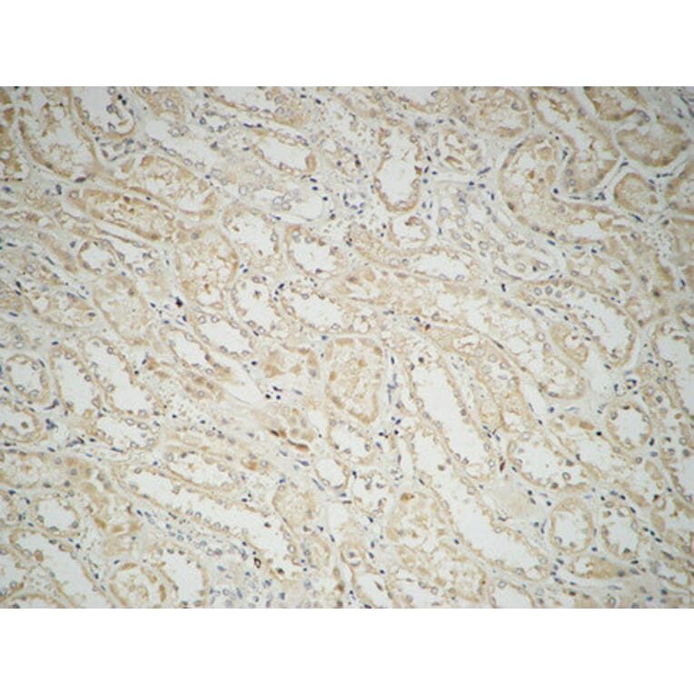 Immunohistochemistry - Anti-Fatty Acid Synthase Antibody (R12-2140) - Antibodies.com