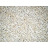 Immunohistochemistry - Anti-Fatty Acid Synthase Antibody (R12-2140) - Antibodies.com