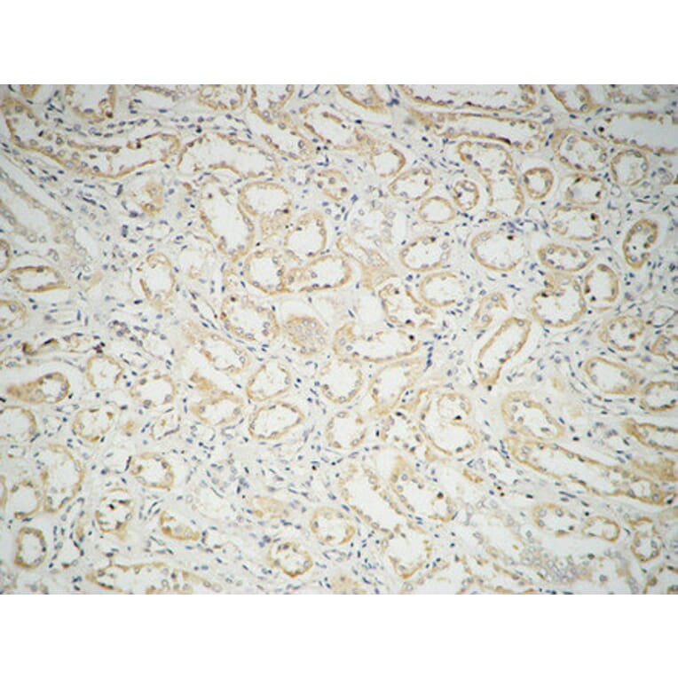 Immunohistochemistry - Anti-Fatty Acid Synthase Antibody (R12-2140) - Antibodies.com