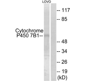 Western Blot - Anti-Cytochrome P450 7B1 Antibody (C12294) - Antibodies.com