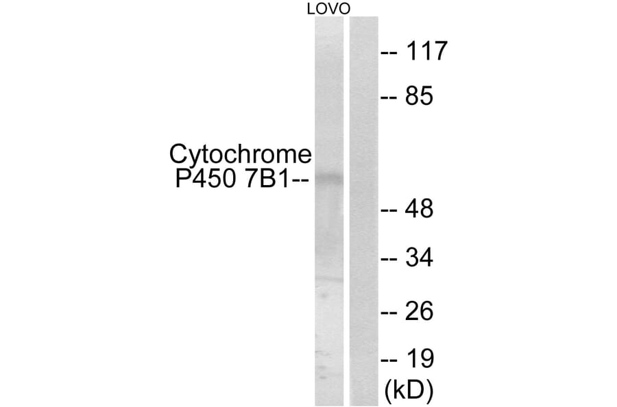 Western Blot - Anti-Cytochrome P450 7B1 Antibody (C12294) - Antibodies.com