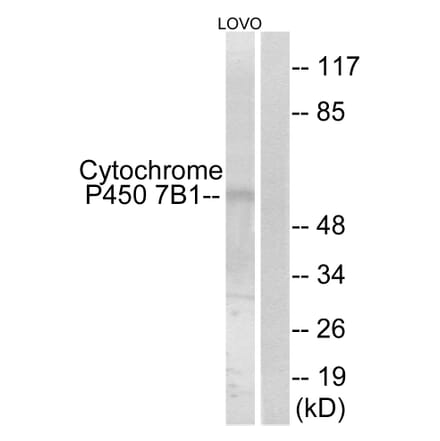 Western Blot - Anti-Cytochrome P450 7B1 Antibody (C12294) - Antibodies.com