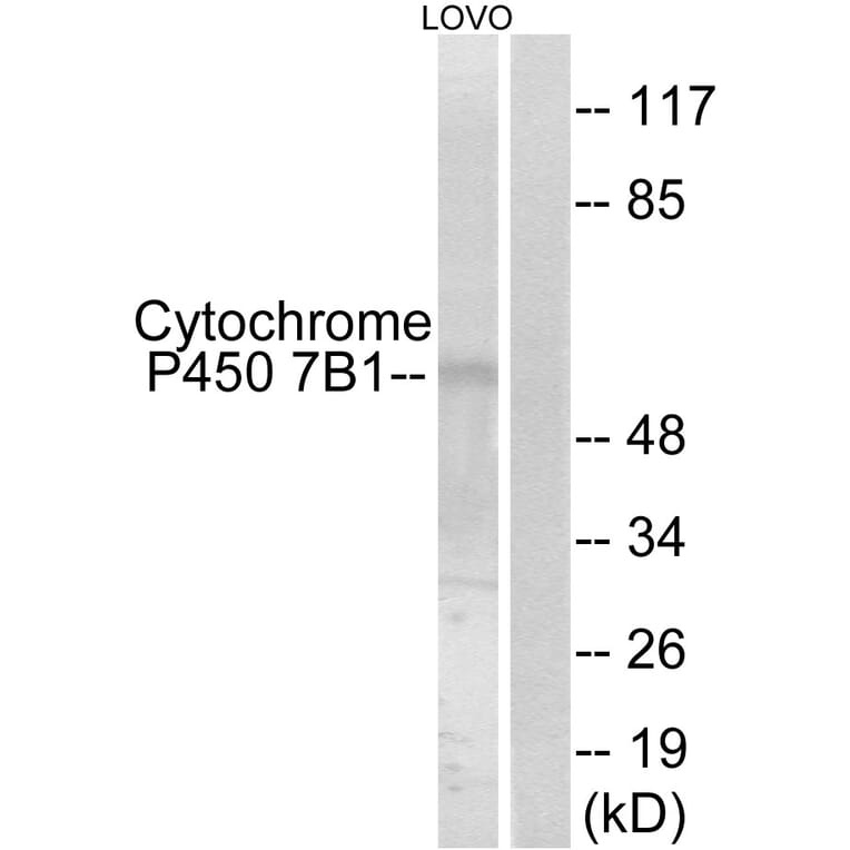 Western Blot - Anti-Cytochrome P450 7B1 Antibody (C12294) - Antibodies.com