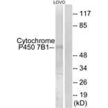 Western Blot - Anti-Cytochrome P450 7B1 Antibody (C12294) - Antibodies.com