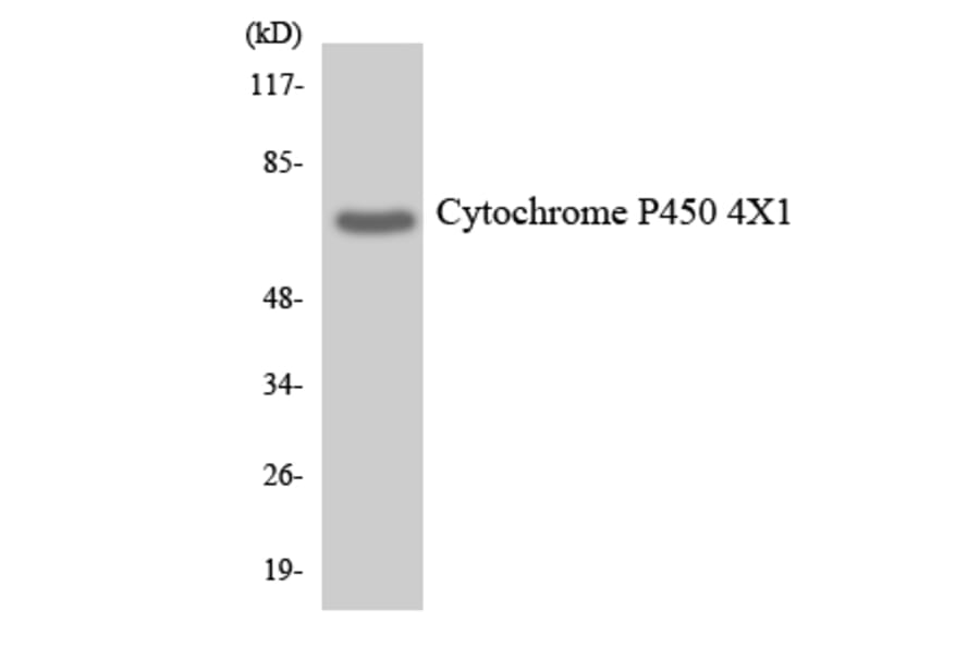 Western Blot - Anti-Cytochrome P450 4X1 Antibody (R12-2684) - Antibodies.com