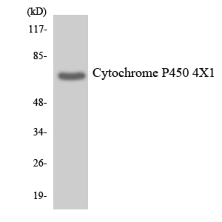 Western Blot - Anti-Cytochrome P450 4X1 Antibody (R12-2684) - Antibodies.com