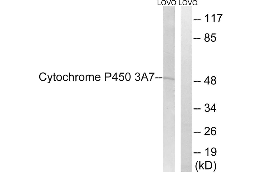 Western Blot - Anti-Cytochrome P450 3A7 Antibody (C21003) - Antibodies.com