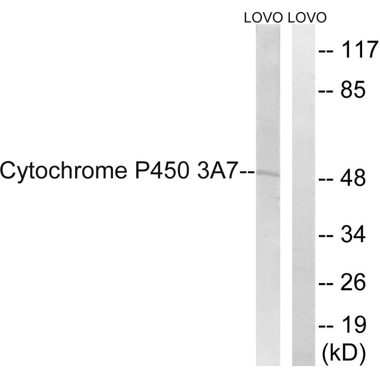 Western Blot - Anti-Cytochrome P450 3A7 Antibody (C21003) - Antibodies.com