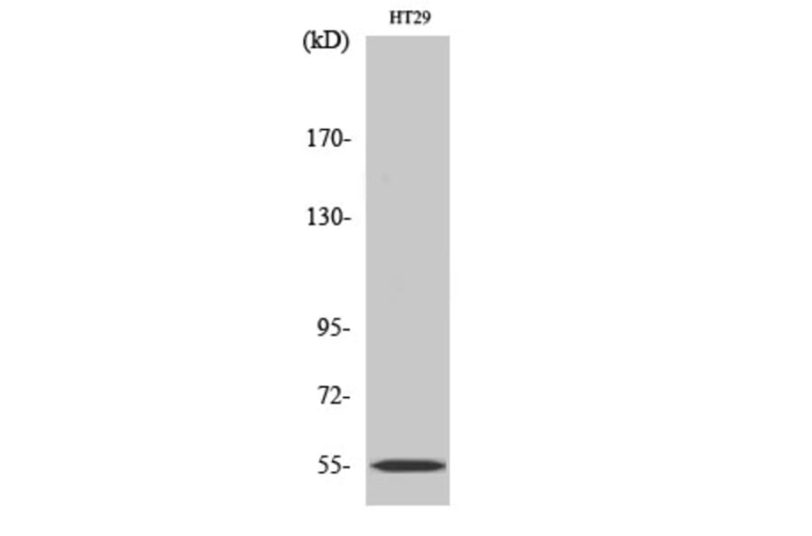 Western Blot - Anti-Cytochrome P450 2D6 Antibody (C12266) - Antibodies.com