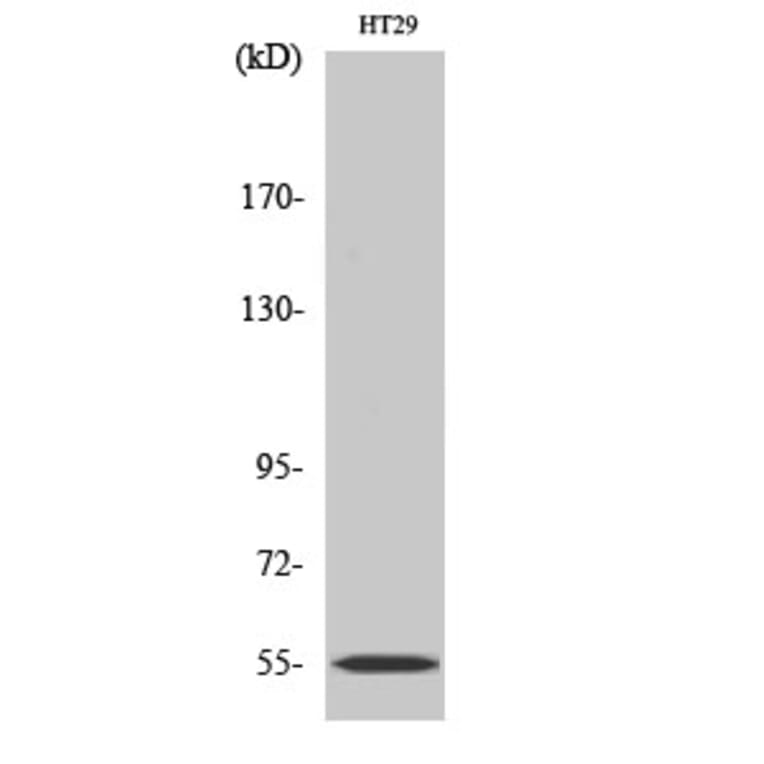 Western Blot - Anti-Cytochrome P450 2D6 Antibody (C12266) - Antibodies.com