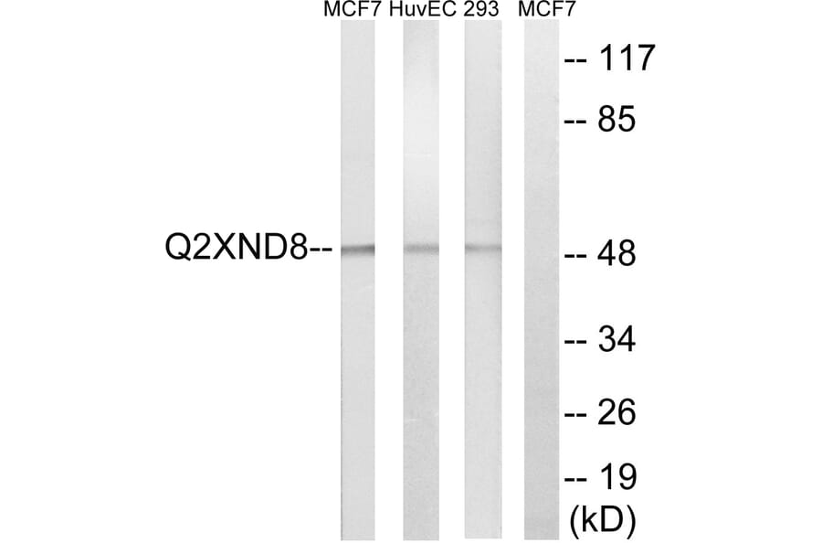 Western Blot - Anti-Cytochrome P450 2D6 Antibody (C21042) - Antibodies.com