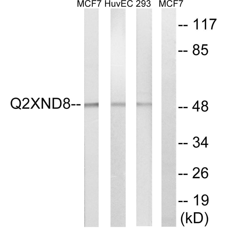 Western Blot - Anti-Cytochrome P450 2D6 Antibody (C21042) - Antibodies.com