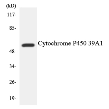 Western Blot - Anti-Cytochrome P450 2D6 Antibody (R12-2676) - Antibodies.com