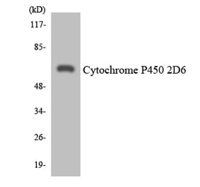 Western Blot - Anti-Cytochrome P450 2D6 Antibody (R12-2677) - Antibodies.com