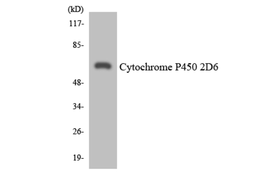 Western Blot - Anti-Cytochrome P450 2D6 Antibody (R12-2677) - Antibodies.com