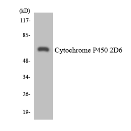 Western Blot - Anti-Cytochrome P450 2D6 Antibody (R12-2677) - Antibodies.com