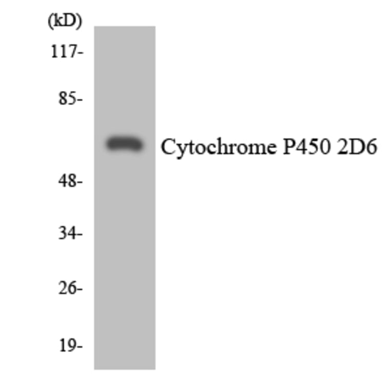 Western Blot - Anti-Cytochrome P450 2D6 Antibody (R12-2677) - Antibodies.com