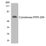 Western Blot - Anti-Cytochrome P450 2D6 Antibody (R12-2677) - Antibodies.com