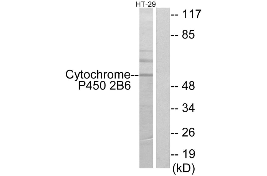 Western Blot - Anti-Cytochrome P450 2B6 Antibody (C12261) - Antibodies.com