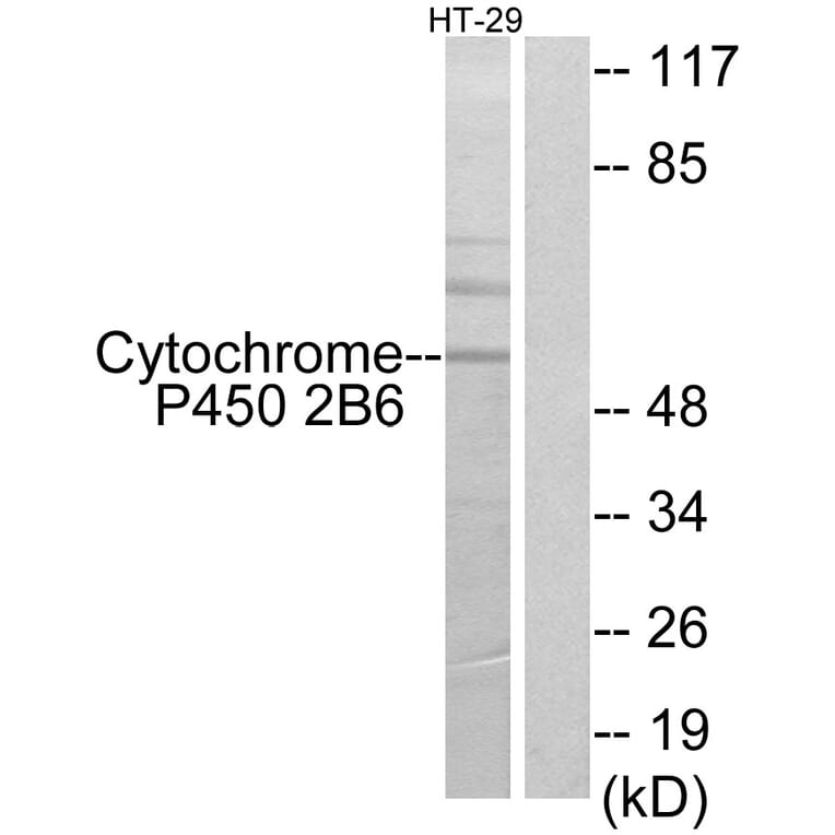 Western Blot - Anti-Cytochrome P450 2B6 Antibody (C12261) - Antibodies.com