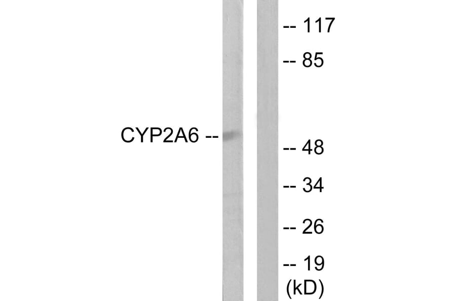 Western Blot - Anti-Cytochrome P450 2A6 Antibody (C12258) - Antibodies.com