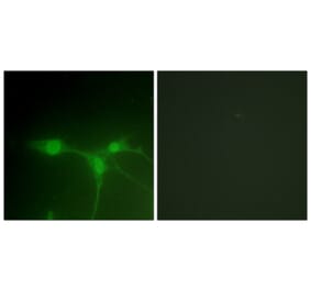 Immunofluorescence - Anti-Breast Tumor Kinase Antibody (B0783) - Antibodies.com