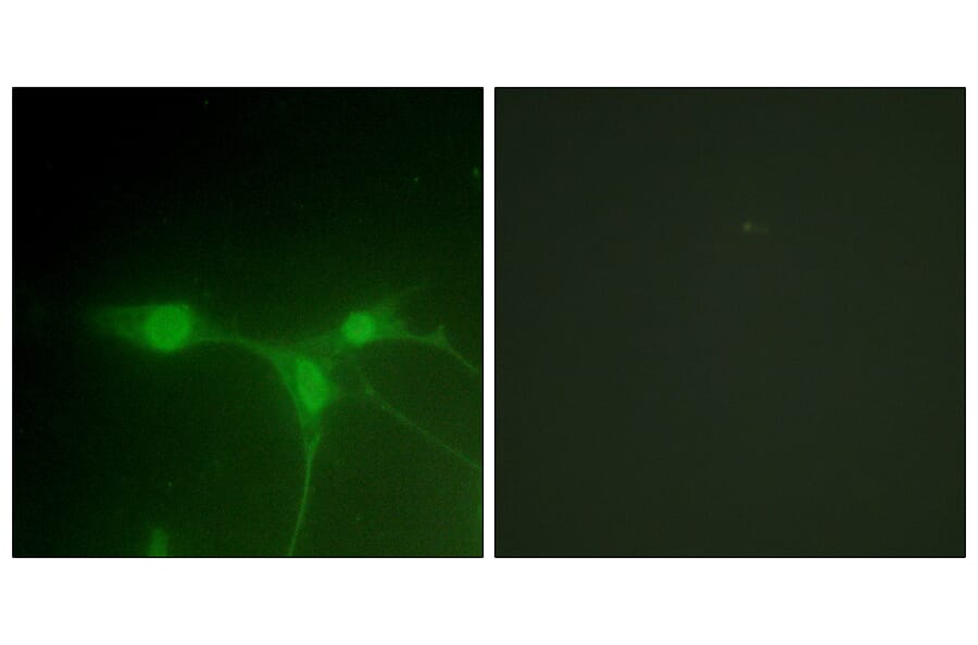 Immunofluorescence - Anti-Breast Tumor Kinase Antibody (B0783) - Antibodies.com