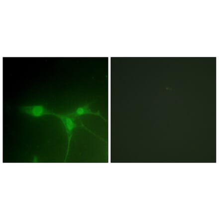 Immunofluorescence - Anti-Breast Tumor Kinase Antibody (B0783) - Antibodies.com