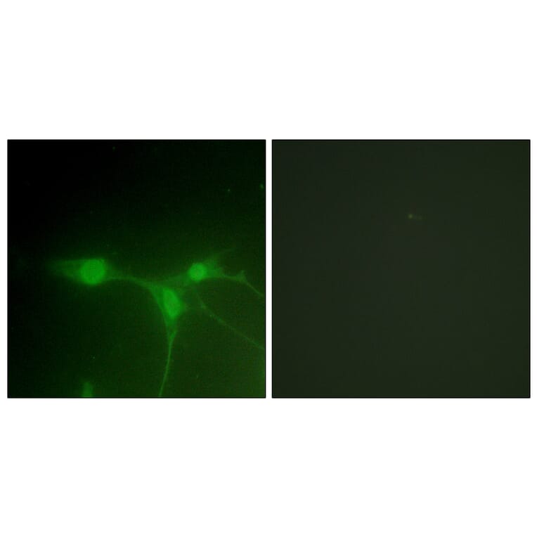 Immunofluorescence - Anti-Breast Tumor Kinase Antibody (B0783) - Antibodies.com