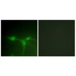 Immunofluorescence - Anti-Breast Tumor Kinase Antibody (B0783) - Antibodies.com
