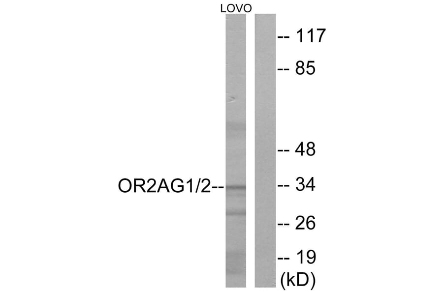 Western Blot - Anti-OR2AG1 + OR2AG2 Antibody (G432) - Antibodies.com