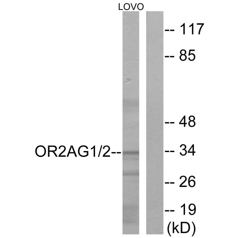 Western Blot - Anti-OR2AG1 + OR2AG2 Antibody (G432) - Antibodies.com