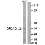 Western Blot - Anti-OR2AG1 + OR2AG2 Antibody (G432) - Antibodies.com