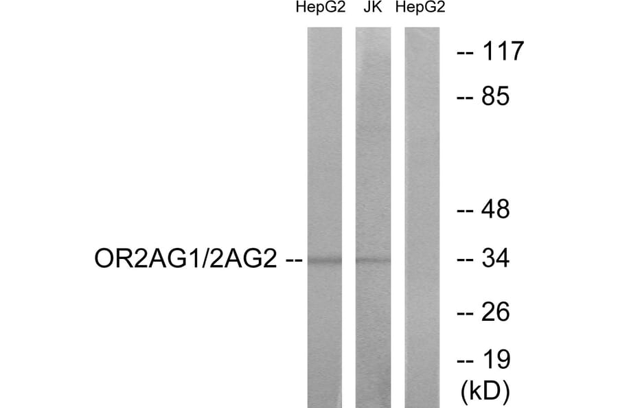 Western Blot - Anti-OR2AG1 + OR2AG2 Antibody (G538) - Antibodies.com