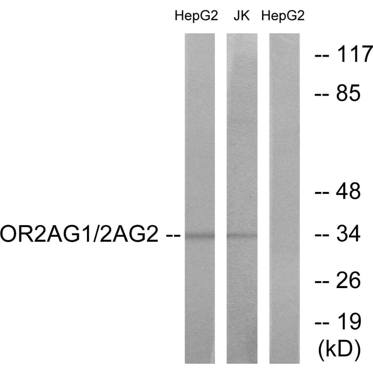 Western Blot - Anti-OR2AG1 + OR2AG2 Antibody (G538) - Antibodies.com