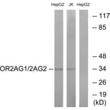 Western Blot - Anti-OR2AG1 + OR2AG2 Antibody (G538) - Antibodies.com