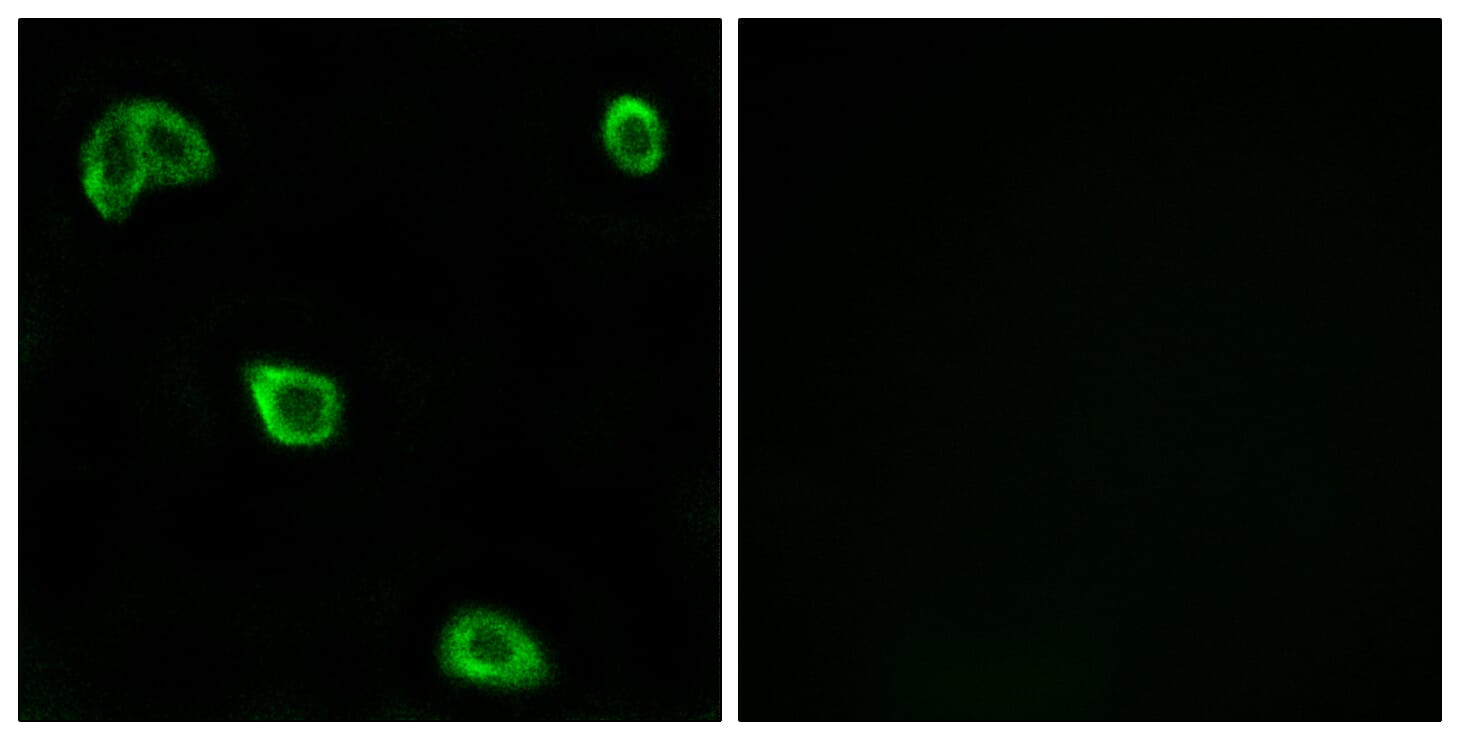 Immunofluorescence analysis of LOVO cells using Anti-OR10K1 + OR10K2 Antibody. The right hand panel represents a negative control, where the antibody was pre-incubated with the immunising peptide.