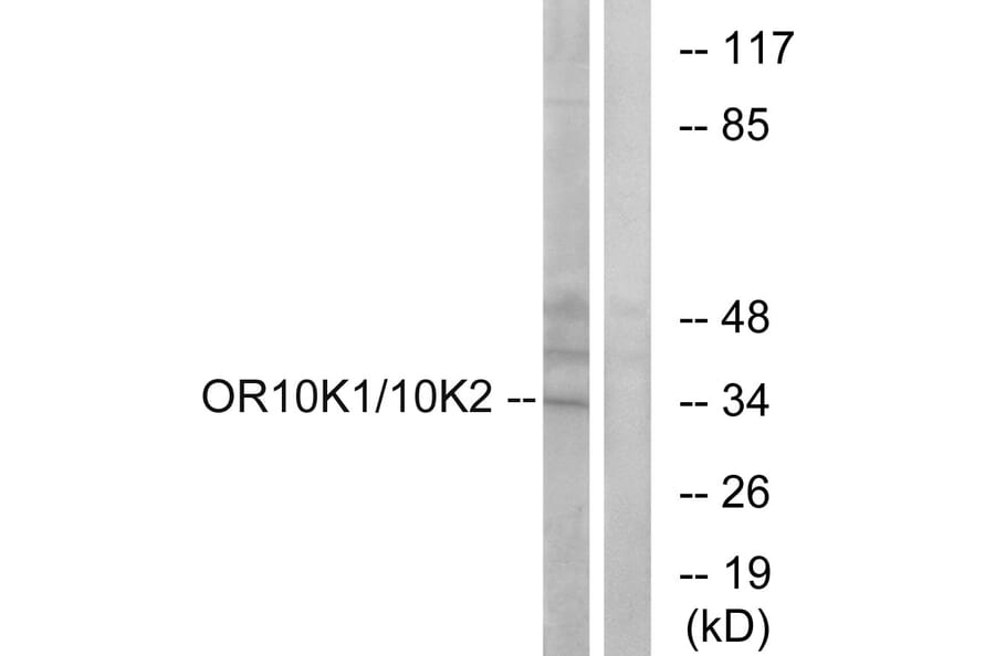 Western Blot - Anti-OR10K1 + OR10K2 Antibody (G880) - Antibodies.com