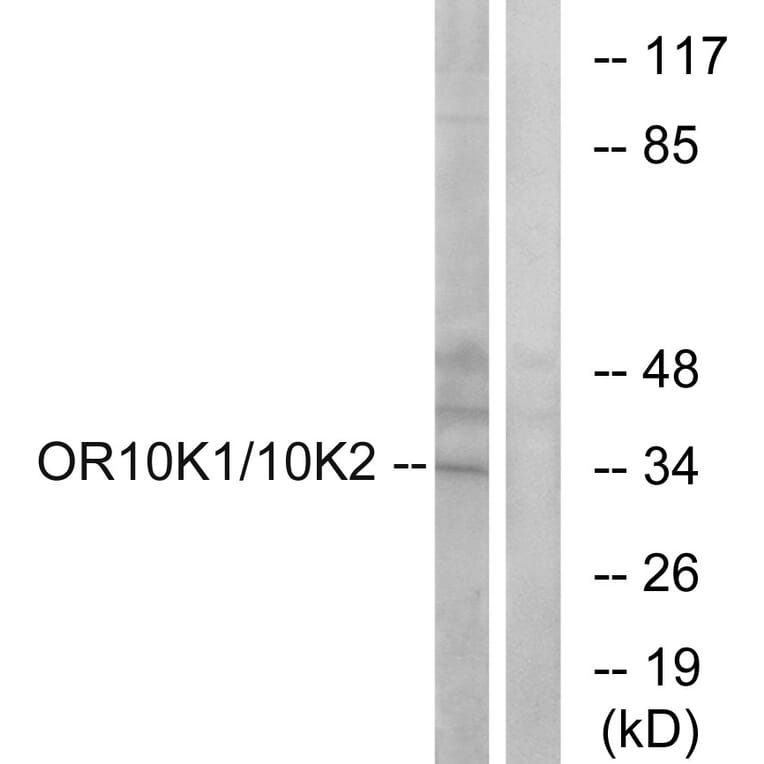 Western Blot - Anti-OR10K1 + OR10K2 Antibody (G880) - Antibodies.com