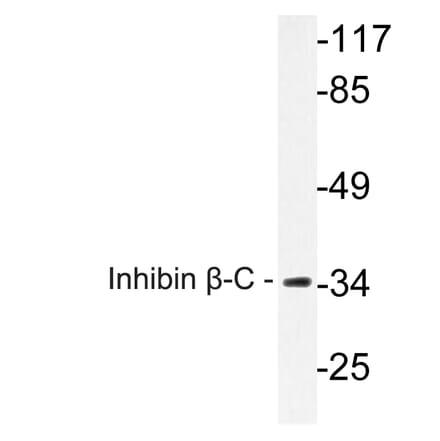 Western Blot - Anti-Inhibin beta-C Antibody (R12-2217) - Antibodies.com