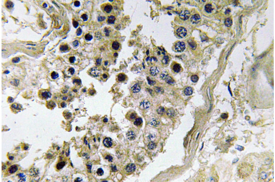 Immunohistochemistry - Anti-Inhibin beta-C Antibody (R12-2217) - Antibodies.com
