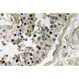 Immunohistochemistry - Anti-Inhibin beta-C Antibody (R12-2217) - Antibodies.com