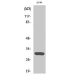 Western Blot - Anti-Inhibin beta-C Antibody (R12-2217) - Antibodies.com