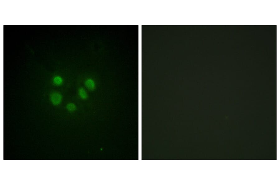 Immunofluorescence - Anti-Bloom Syndrome Antibody (B0778) - Antibodies.com